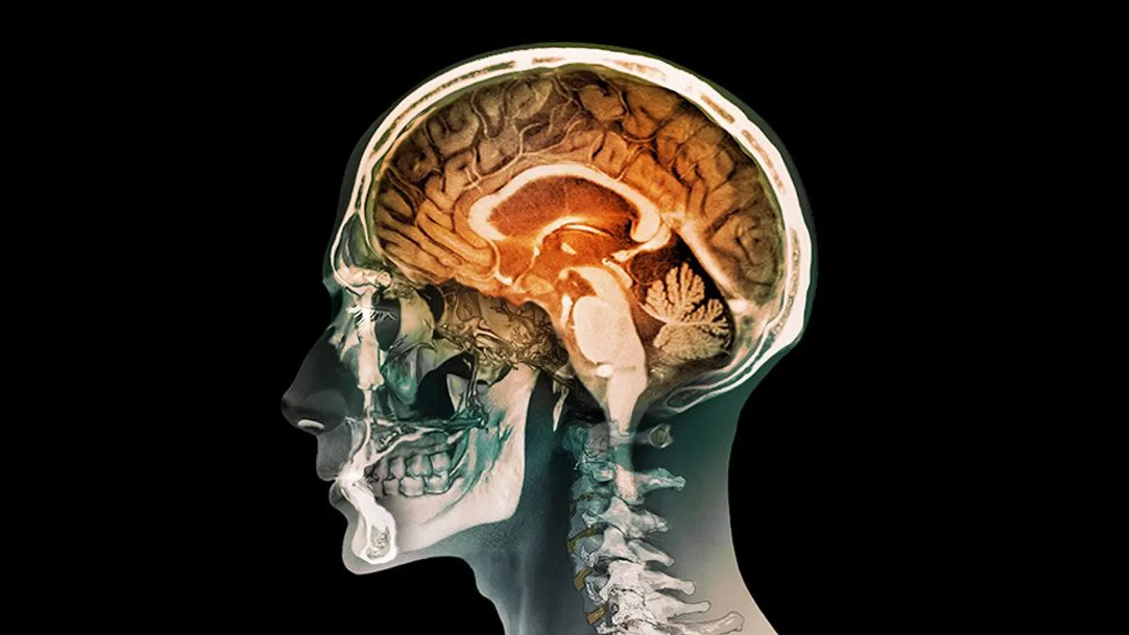 Neural circuits